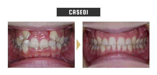 case01