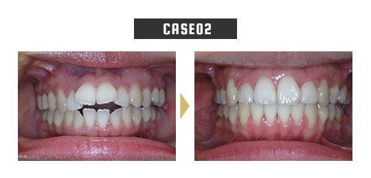 case02