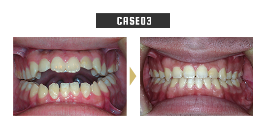 case03